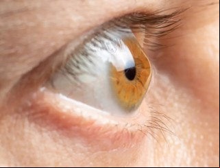 Coçar os olhos pode levar a um grave prejuízo na visão, alerta SGO
