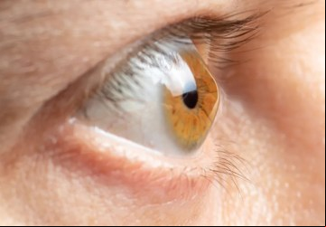 Ceratocone é uma deformação da córnea, que pode levar a embaçamento visual, perda da nitidez para longe e para perto Shutterstock